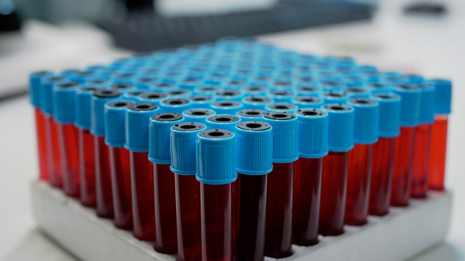 Coleta de exame de sangue em laboratório para dosagem de TSH e T4 livre