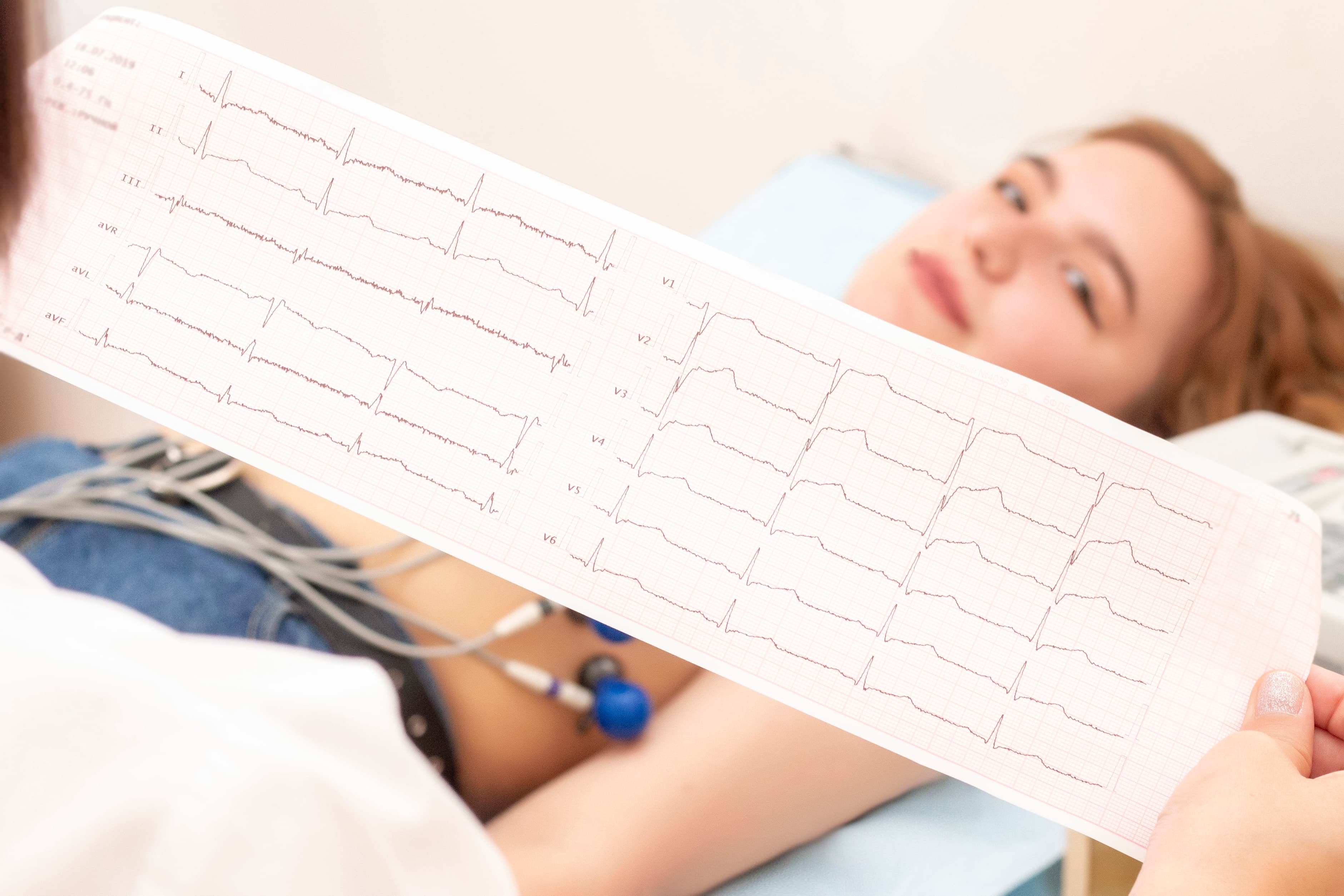 Meu ECG Veio Alterado: Preciso Me Preocupar?