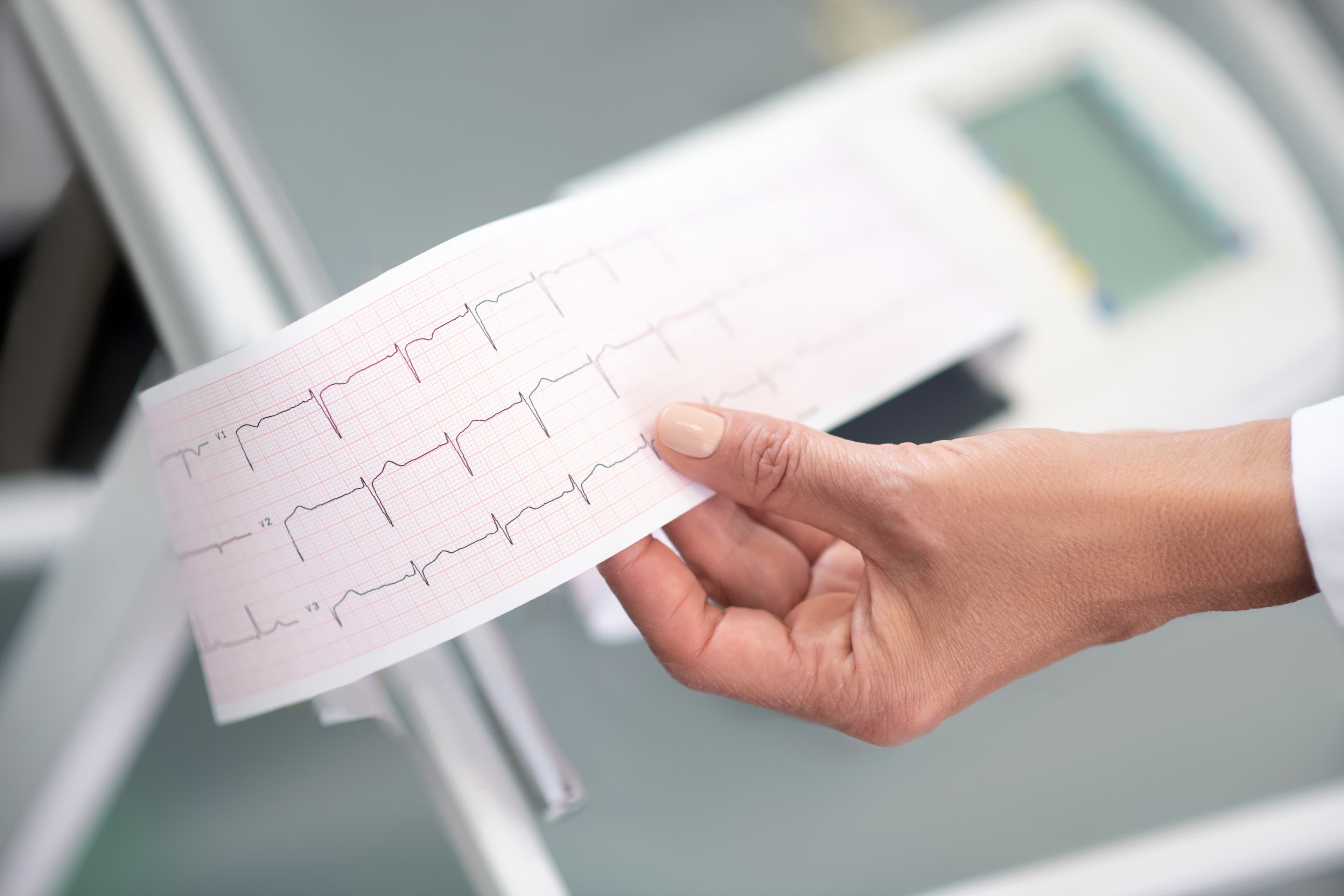 O que é RQE e por que ele importa na hora de escolher um cardiologista
