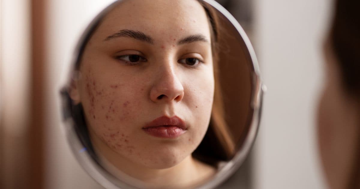 Avaliação da pele do rosto em consulta dermatológica online