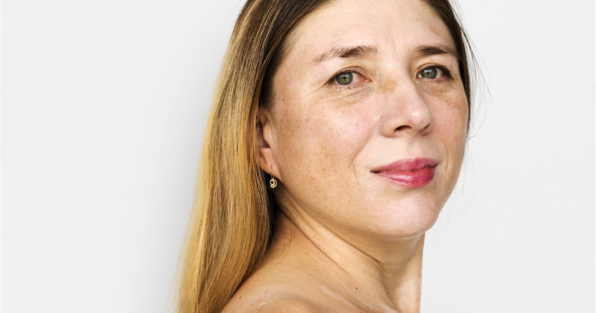 Retrato mostrando detalhes da pele do rosto, avaliada durante consulta dermatológica