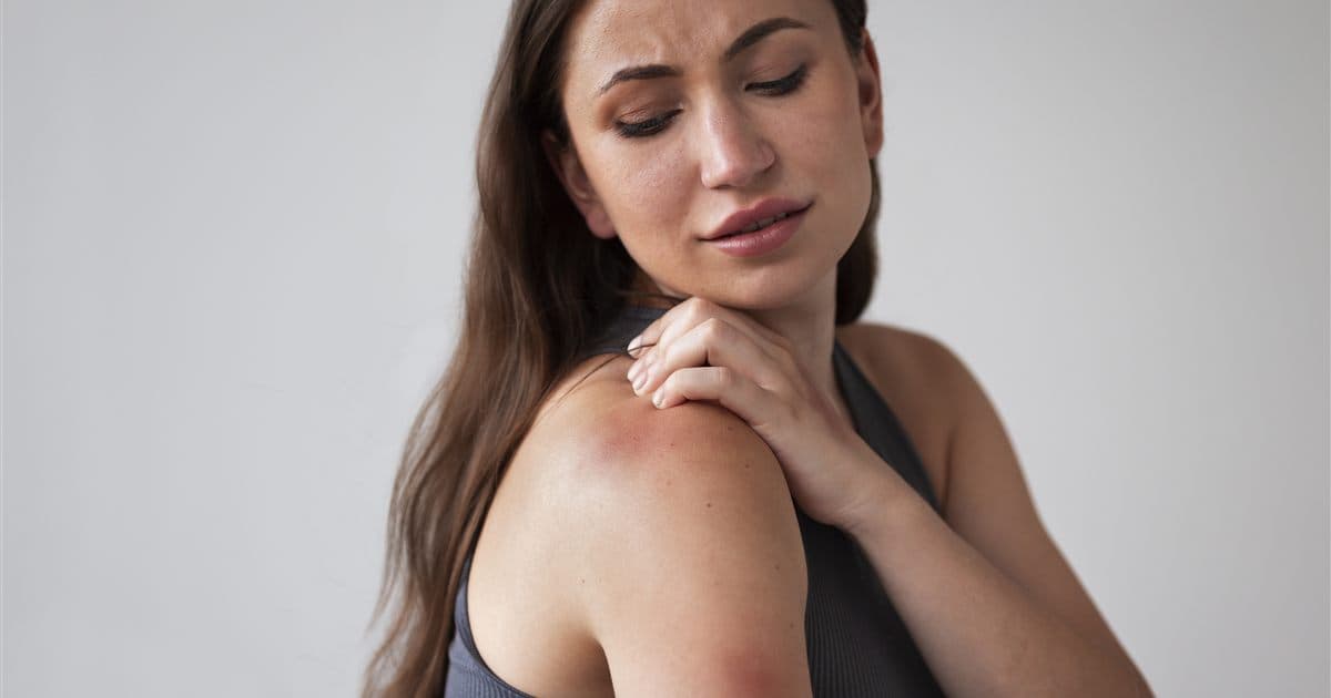 Dermatite atópica: sintomas, causas e tratamento