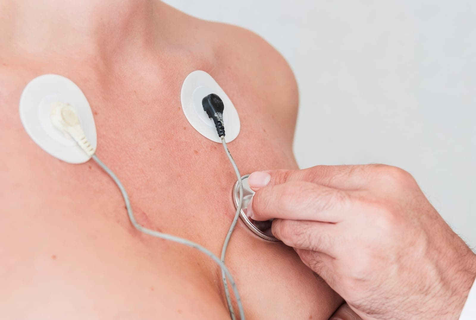 Técnico posicionando eletrodos no tórax do paciente para realizar eletrocardiograma
