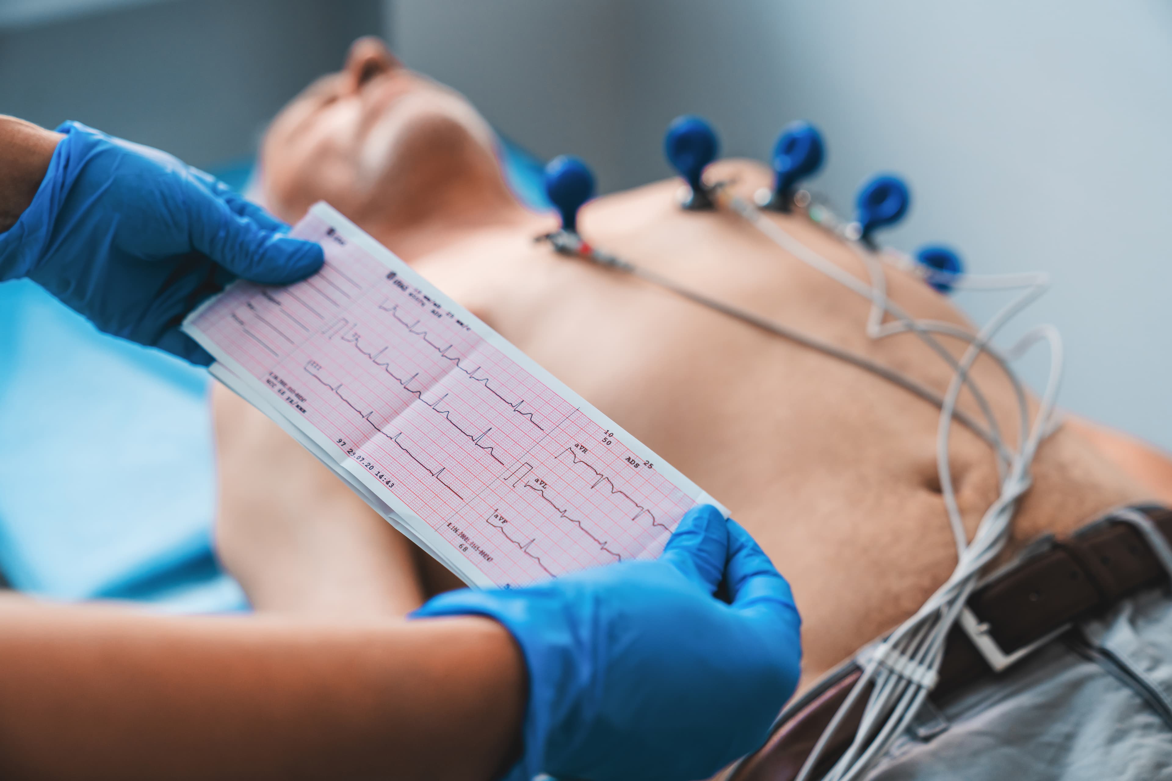 O Que É Eletrocardiograma (ECG): Para Que Serve e Como É Feito o Exame