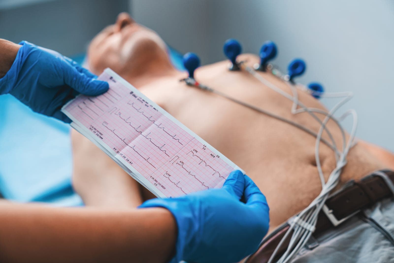O Que É Eletrocardiograma (ECG): Para Que Serve e Como É Feito o Exame