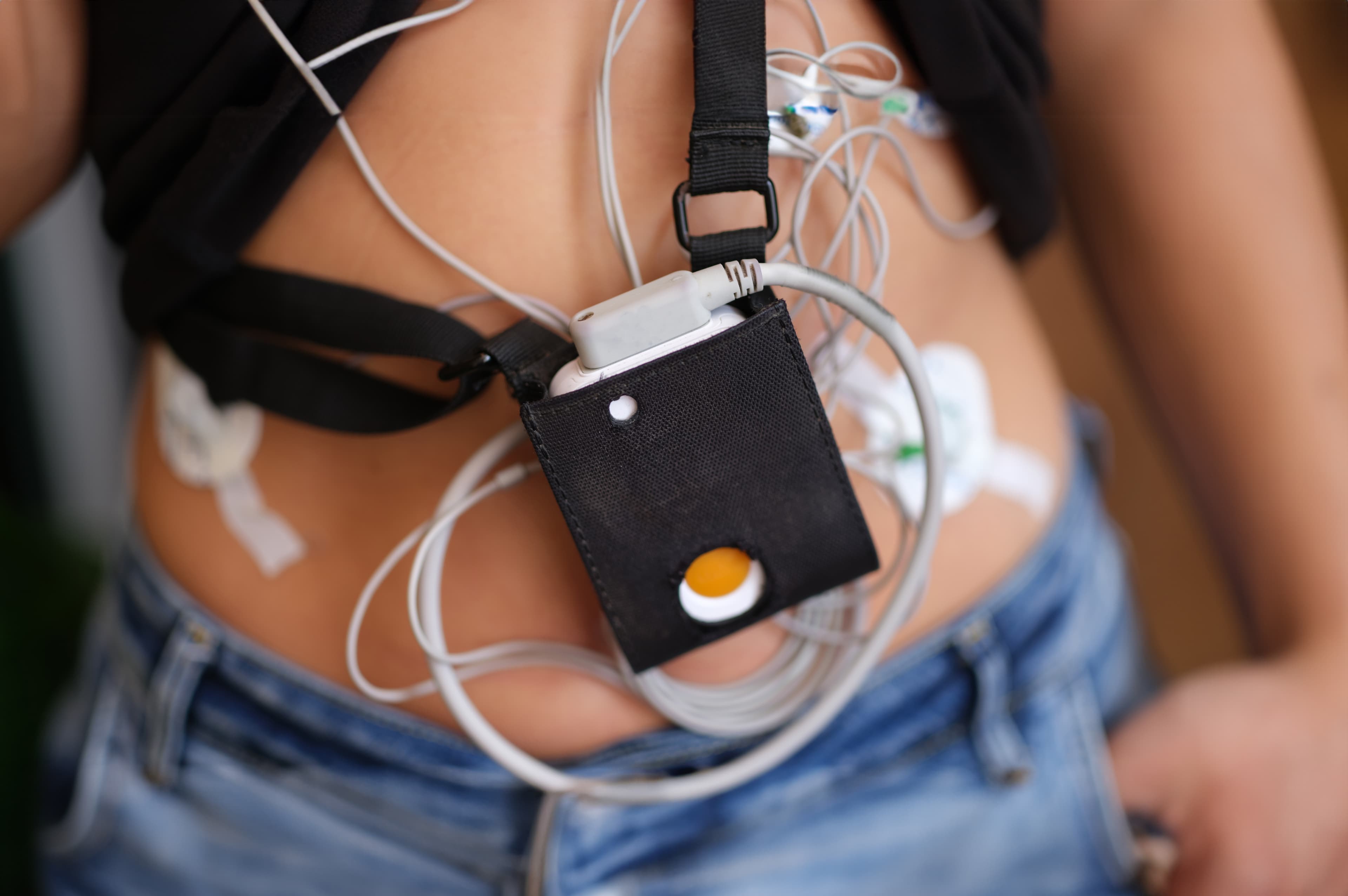 Holter: Para Que Serve o Exame Que Monitora o Coração por 24 Horas