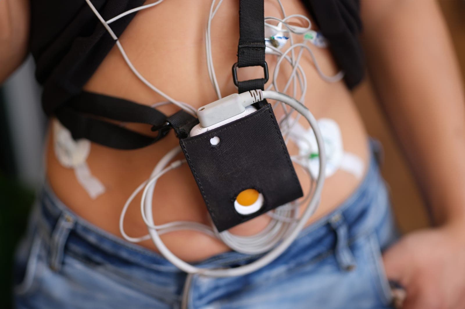 Holter: Para Que Serve o Exame Que Monitora o Coração por 24 Horas