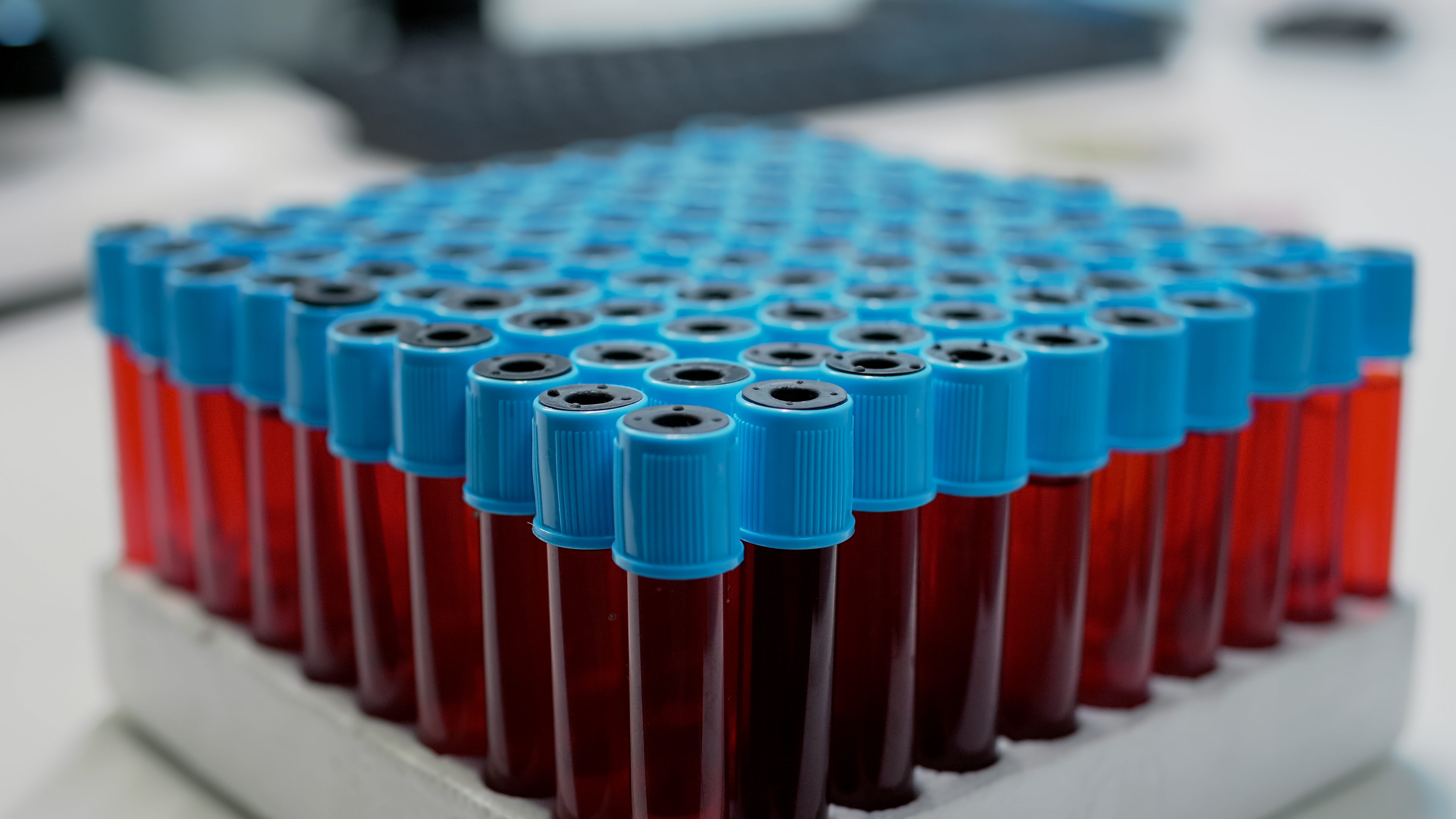 Tubos de coleta de sangue para hemograma em bancada de laboratório