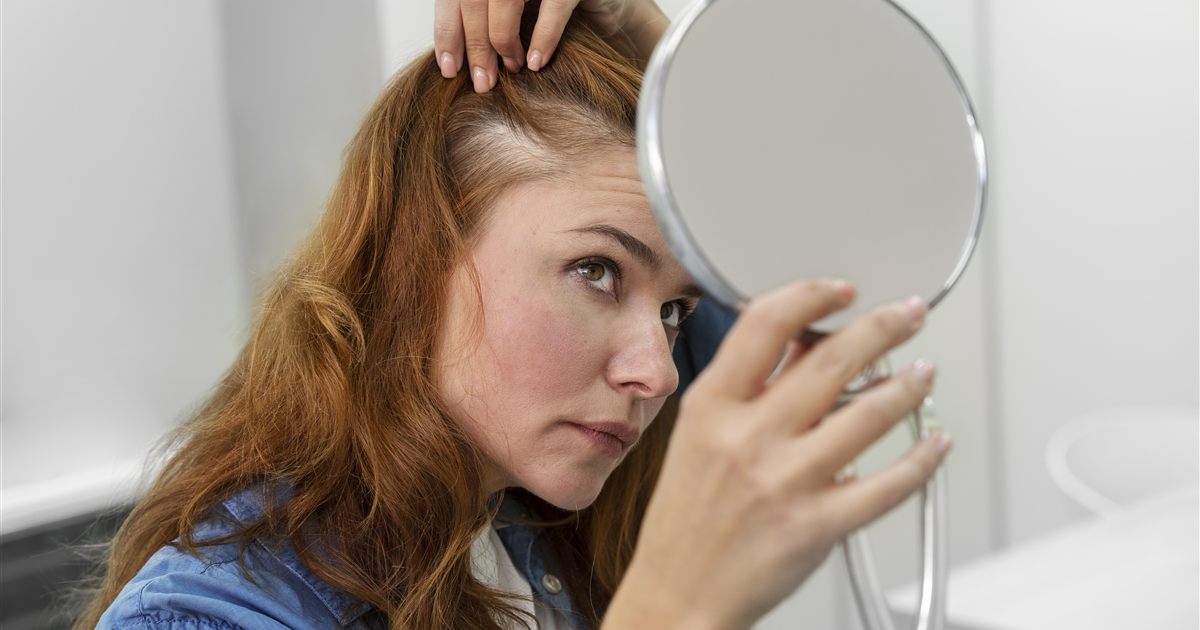 Mulher observando o couro cabeludo no espelho para avaliar a linha de cabelo